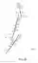 Fig. 42 - Arthroplasty jigs with mating accuracy