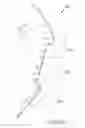 Fig. 43 - Arthroplasty jigs with mating accuracy