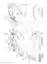 Fig. 52 - Arthroplasty jigs with mating accuracy