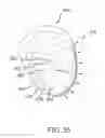 Fig. 55 - Arthroplasty jigs with mating accuracy