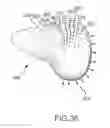 Fig. 58 - Arthroplasty jigs with mating accuracy