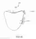 Fig. 66 - Arthroplasty jigs with mating accuracy