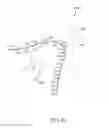 Fig. 68 - Arthroplasty jigs with mating accuracy