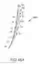 Fig. 69 - Arthroplasty jigs with mating accuracy