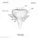 Fig. 72 - Arthroplasty jigs with mating accuracy