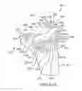 Fig. 76 - Arthroplasty jigs with mating accuracy
