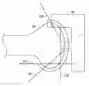 Fig. 01 - System and methods for positioning bone cut guide