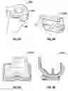 Fig. 04 - System and methods for positioning bone cut guide
