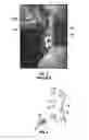 Fig. 02 - Systems and methods for implantation of spinal plate