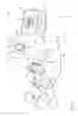 Fig. 02 - Registration of an anatomical image  with a position-tracking coordinate system based on visual proximity to bone tissue