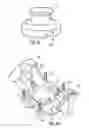 Fig. 06 - Surgical navigation systems