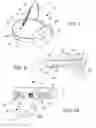 Fig. 07 - Robotic surgical assembly