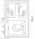 Fig. 04 - Integrated surgical implant delivery system and method
