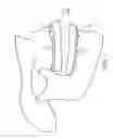 Fig. 02 - Masticatory orthodontic correction device and method for making the same