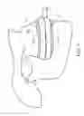 Fig. 07 - Masticatory orthodontic correction device and method for making the same