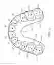 Fig. 09 - Masticatory orthodontic correction device and method for making the same
