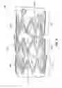 Fig. 07 - DEPLOYABLE STENTS AND RELATED DEVICES, SYSTEMS, AND METHODS