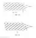 Fig. 09 - ENDOVASCULAR DEVICE FOR SENSING AND OR STIMULATING TISSUE