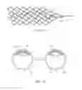 Fig. 12 - ENDOVASCULAR DEVICE FOR SENSING AND OR STIMULATING TISSUE