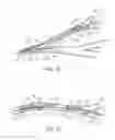 Fig. 22 - ENDOVASCULAR DEVICE FOR SENSING AND OR STIMULATING TISSUE