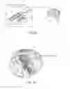 Fig. 24 - ENDOVASCULAR DEVICE FOR SENSING AND OR STIMULATING TISSUE
