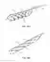Fig. 29 - ENDOVASCULAR DEVICE FOR SENSING AND OR STIMULATING TISSUE
