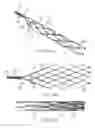 Fig. 53 - ENDOVASCULAR DEVICE FOR SENSING AND OR STIMULATING TISSUE