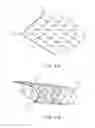 Fig. 65 - ENDOVASCULAR DEVICE FOR SENSING AND OR STIMULATING TISSUE