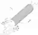 Fig. 01 - Woven prosthesis and method for manufacturing the same