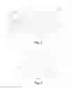 Fig. 03 - Multifocal lens and method for producing same