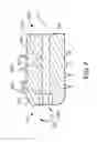 Fig. 08 - Tissue Fixation Systems, Delivery Tools, and Associated Methods and Kits