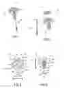 Fig. 02 - Tissue Fixation Systems, Delivery Tools, and Associated Kits and Methods