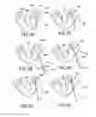 Fig. 10 - Tissue Fixation Systems, Delivery Tools, and Associated Kits and Methods