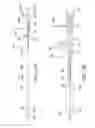 Fig. 03 - Integrated heart valve delivery system