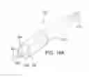 Fig. 16 - Integrated heart valve delivery system