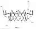 Fig. 02 - CATHETER-BASED DELIVERY DEVICE HAVING SEGMENT WITH NON-UNIFORM WIDTH HELICAL SPINE