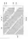 Fig. 06 - CATHETER-BASED DELIVERY DEVICE HAVING SEGMENT WITH NON-UNIFORM WIDTH HELICAL SPINE