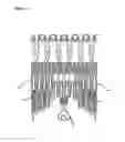 Fig. 04 - Atrio-ventricular valve stent with native leaflet grasping and holding mechanism