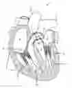 Fig. 01 - Papillary muscle adjustment