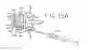 Fig. 05 - SPINAL TISSUE DISTRACTION DEVICES