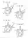 Fig. 20 - SPINAL TISSUE DISTRACTION DEVICES