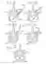 Fig. 22 - SPINAL TISSUE DISTRACTION DEVICES