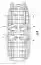 Fig. 07 - Expandable and adjustable lordosis interbody fusion system