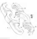 Fig. 10 - Expandable and adjustable lordosis interbody fusion system