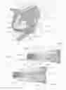 Fig. 02 - Expandable intervertebral implant