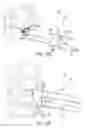Fig. 06 - Spinal joint implant delivery device and system