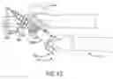Fig. 25 - Spinal joint implant delivery device and system