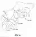 Fig. 29 - Spinal joint implant delivery device and system