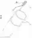 Fig. 17 - Electronic artificial hand