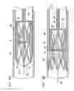 Fig. 04 - VASCULAR IMPLANT
